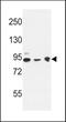 DnaJ Heat Shock Protein Family (Hsp40) Member C6 antibody, TA325123, Origene, Western Blot image 