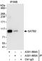 SATB Homeobox 2 antibody, A301-864A, Bethyl Labs, Immunoprecipitation image 