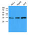 Carbonyl Reductase 1 antibody, AM09388PU-S, Origene, Western Blot image 