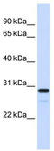 Family With Sequence Similarity 78 Member B antibody, TA339963, Origene, Western Blot image 