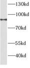 Angiogenic factor with G patch and FHA domains 1 antibody, FNab00212, FineTest, Western Blot image 