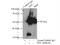 Aromatic-L-amino-acid decarboxylase antibody, 10166-1-AP, Proteintech Group, Immunoprecipitation image 