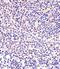 NK2 Homeobox 5 antibody, PA5-49431, Invitrogen Antibodies, Immunohistochemistry frozen image 