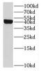 Interleukin 10 Receptor Subunit Beta antibody, FNab04215, FineTest, Western Blot image 