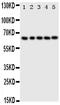 Tumor Protein P63 antibody, PA2056, Boster Biological Technology, Western Blot image 