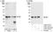 Microtubule Associated Protein RP/EB Family Member 1 antibody, A302-331A, Bethyl Labs, Immunoprecipitation image 