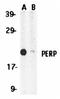 P53 Apoptosis Effector Related To PMP22 antibody, orb74448, Biorbyt, Western Blot image 