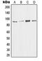 Hdm2 antibody, LS-C352508, Lifespan Biosciences, Western Blot image 