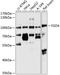 FYVE, RhoGEF And PH Domain Containing 4 antibody, GTX64656, GeneTex, Western Blot image 