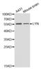 LYN Proto-Oncogene, Src Family Tyrosine Kinase antibody, AHP2494, Bio-Rad (formerly AbD Serotec) , Western Blot image 