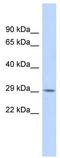 Regulatory Factor X Associated Protein antibody, TA332359, Origene, Western Blot image 