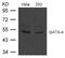 GATA Binding Protein 4 antibody, 79-686, ProSci, Western Blot image 
