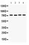 Fragile X Mental Retardation 1 antibody, PB9703, Boster Biological Technology, Western Blot image 