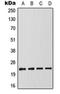 CASP2 And RIPK1 Domain Containing Adaptor With Death Domain antibody, orb214824, Biorbyt, Western Blot image 