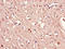 Ras-related protein Rab-39B antibody, LS-C399550, Lifespan Biosciences, Immunohistochemistry paraffin image 