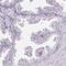 Hydroxysteroid 17-Beta Dehydrogenase 3 antibody, HPA056833, Atlas Antibodies, Immunohistochemistry paraffin image 