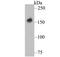 Death Associated Protein Kinase 1 antibody, NBP2-76835, Novus Biologicals, Western Blot image 