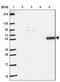 Carboxyl-terminal PDZ ligand of neuronal nitric oxide synthase protein antibody, NBP2-38758, Novus Biologicals, Western Blot image 
