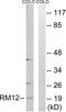 Mitochondrial Ribosomal Protein L12 antibody, LS-C119621, Lifespan Biosciences, Western Blot image 