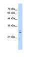 CAMP Responsive Element Modulator antibody, orb329795, Biorbyt, Western Blot image 