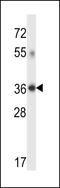 Dehydrogenase/Reductase 7C antibody, 57-274, ProSci, Western Blot image 