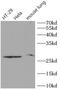 TIMP Metallopeptidase Inhibitor 1 antibody, FNab08706, FineTest, Western Blot image 