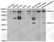 NK2 Homeobox 5 antibody, A5651, ABclonal Technology, Western Blot image 