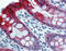 Keratin 18 antibody, 51-275, ProSci, Immunohistochemistry paraffin image 