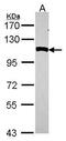 Aminopeptidase Puromycin Sensitive antibody, PA5-22383, Invitrogen Antibodies, Western Blot image 