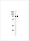 Netrin 1 antibody, 60-993, ProSci, Western Blot image 