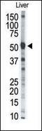 Matrix Metallopeptidase 8 antibody, PA5-13198, Invitrogen Antibodies, Western Blot image 
