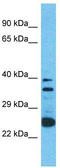 Olfactory Receptor Family 2 Subfamily A Member 12 antibody, TA337485, Origene, Western Blot image 