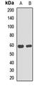 CGAS antibody, orb412701, Biorbyt, Western Blot image 