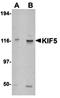 Fms Related Tyrosine Kinase 3 antibody, orb5253, Biorbyt, Western Blot image 