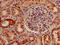 Solute Carrier Family 33 Member 1 antibody, CSB-PA13339A0Rb, Cusabio, Immunohistochemistry paraffin image 