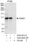 Proteasome 26S Subunit, Non-ATPase 1 antibody, A303-851A, Bethyl Labs, Immunoprecipitation image 