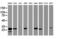 Estradiol 17-beta-dehydrogenase 8 antibody, M08741, Boster Biological Technology, Western Blot image 