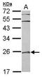 RAB29, Member RAS Oncogene Family antibody, GTX117740, GeneTex, Western Blot image 