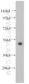 Carnosine Dipeptidase 2 antibody, 14925-1-AP, Proteintech Group, Western Blot image 