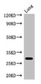 Proteasome Subunit Beta 5 antibody, CSB-PA010083LA01HU, Cusabio, Western Blot image 