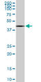 Graves disease carrier protein antibody, LS-C198522, Lifespan Biosciences, Western Blot image 