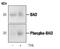 BCL2 Associated Agonist Of Cell Death antibody, MA5-15085, Invitrogen Antibodies, Western Blot image 
