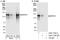 Epidermal Growth Factor Receptor Pathway Substrate 15 antibody, A301-732A, Bethyl Labs, Immunoprecipitation image 