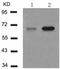 PXN antibody, TA323769, Origene, Western Blot image 