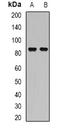 Structure Specific Recognition Protein 1 antibody, orb341073, Biorbyt, Western Blot image 