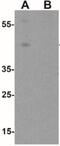 Wnt Family Member 5B antibody, NBP2-41306, Novus Biologicals, Western Blot image 