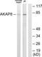 A-Kinase Anchoring Protein 8 antibody, TA326101, Origene, Western Blot image 