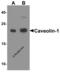 Caveolin 1 antibody, 8219, ProSci Inc, Western Blot image 