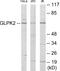 Glycerol Kinase 2 antibody, EKC1810, Boster Biological Technology, Western Blot image 