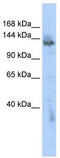 Zinc Finger MYND-Type Containing 8 antibody, TA337718, Origene, Western Blot image 